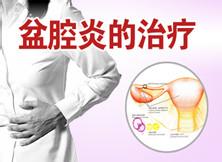 盆腔炎怎样治疗好
